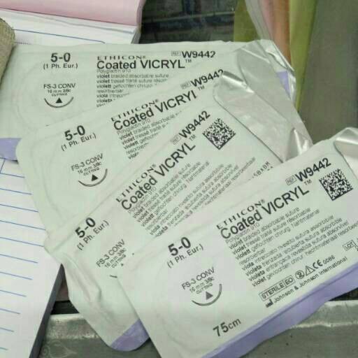 coated Vicryl 5/0
