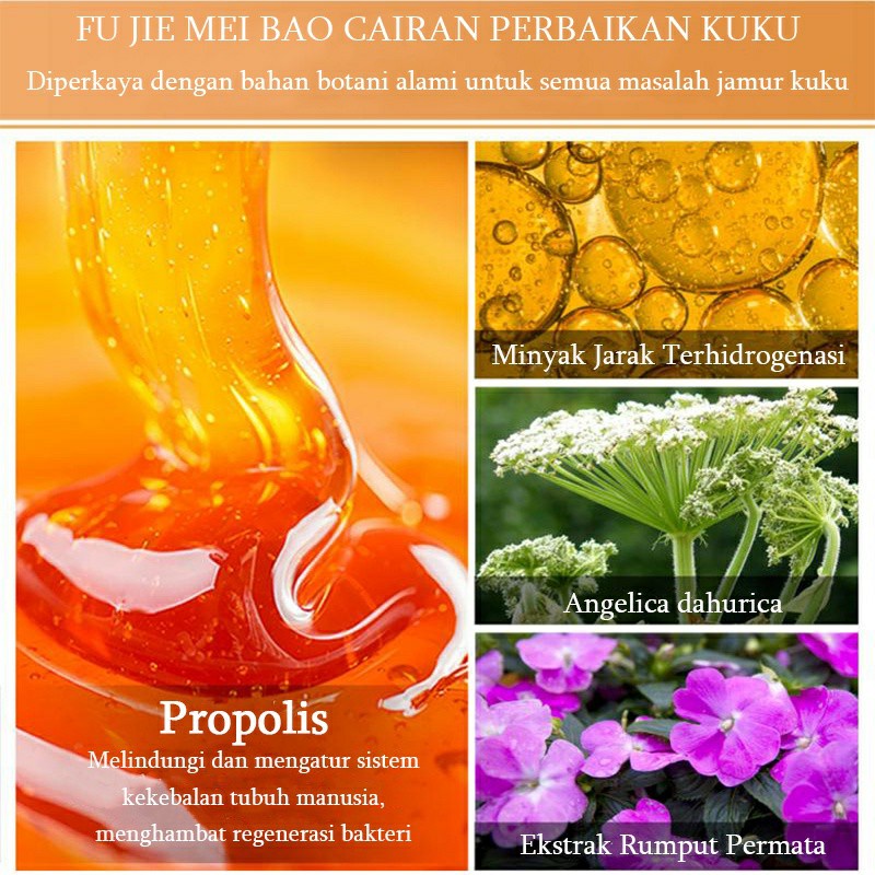 Perawatan kuku Obat jamur kuku 25ml kuku menebal / Atrofi kuku / lapisan kuku / kuku rontok / perubahan warna kuku / kuku bergelombang