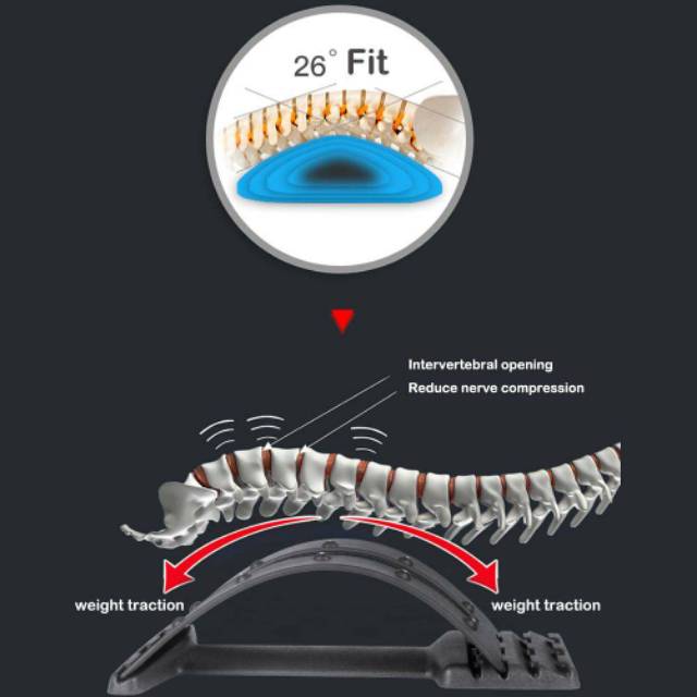 BACKCARE Magnet  Alat Terapi Pinggang Punggung Belakang &amp; Syaraf Kejepit