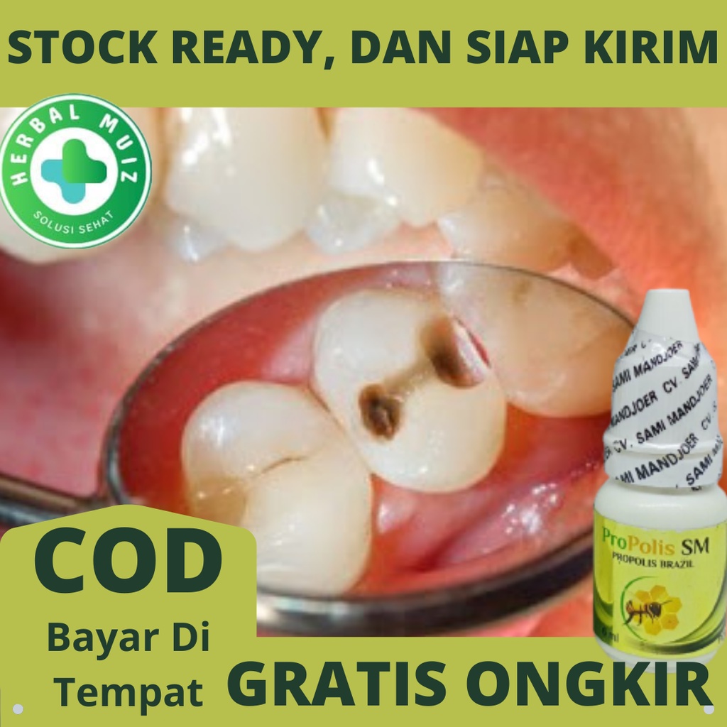 Obat Herbal Polip Pulpa, Polip Gigi, Polip Gusi, Daging Bernanah nanahan Di Gigi &Gusi - PROPOLIS SM