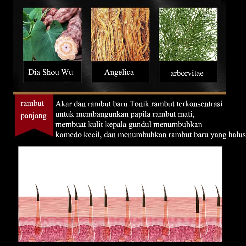 serum penumbuh rambut serum rambut rontok penumbuh rambut penumbuh rambut botak 30ml penumbuh rambut/penumbuh rambut botak/serum penumbuh rambut/Memperbaiki folikel rambut/merangsang pertumbuhan rambut/perawatan rambut