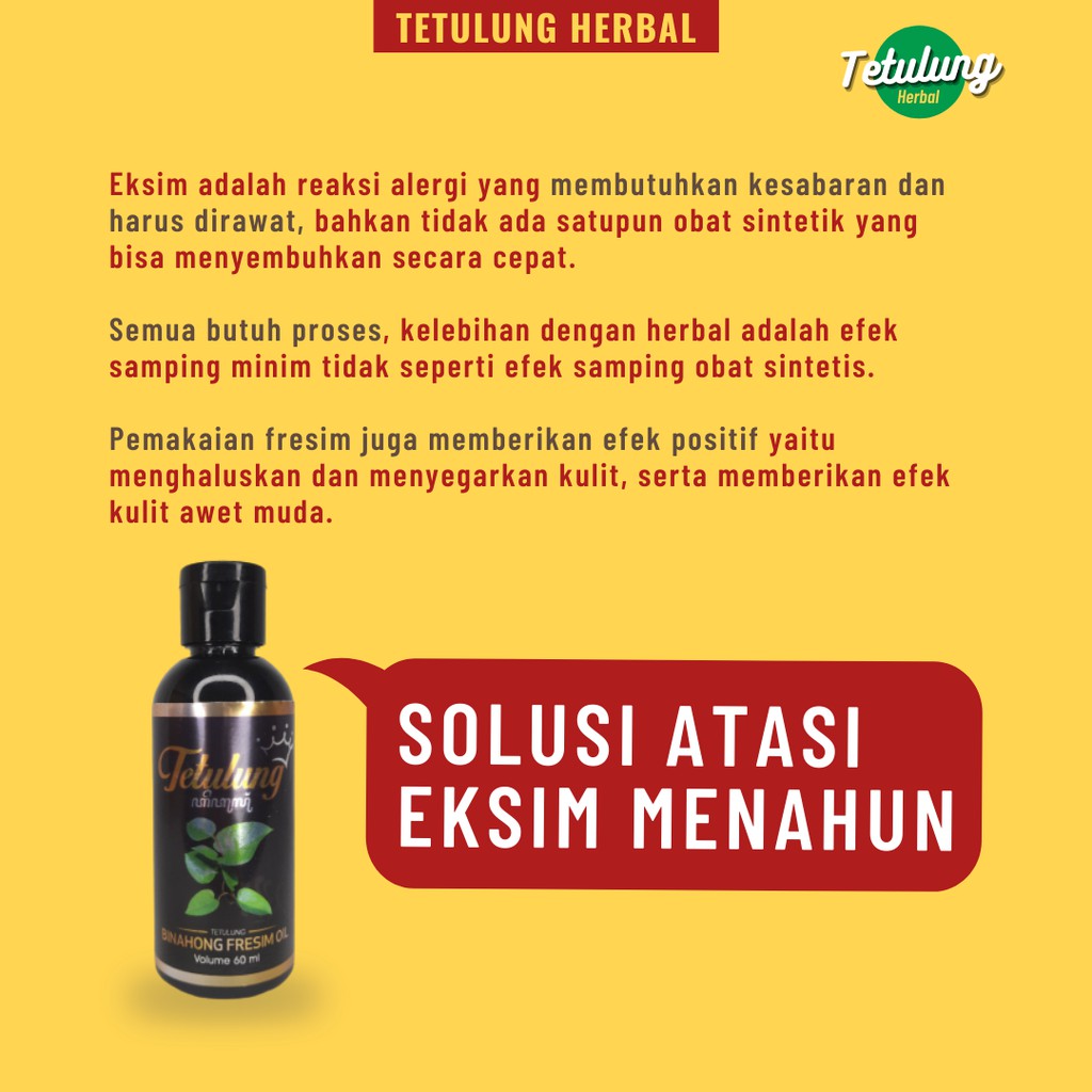 Jual Tetulung Freshim Oil 10ml Minyak Eksim Exim Basah Dan Kering Indonesia Shopee Indonesia