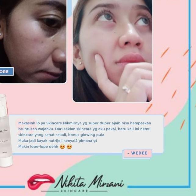 ❃ Nikita Mirzani Skincare [] [FREE GIFT + FREE ONGKIR] 100% ORIGINAL ODDBSC ➳