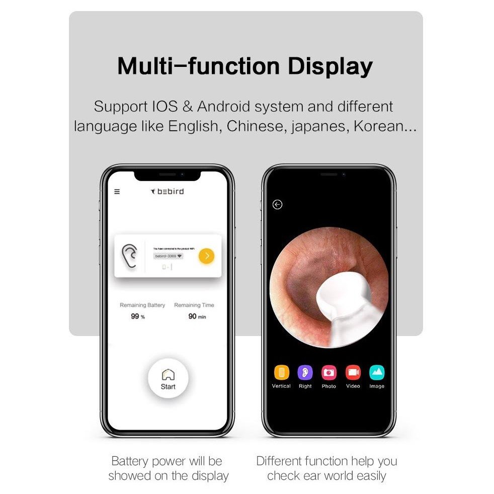 XIAOMI BEBIRD X17 PRO - Smart Visual Ear Stick with 3MP Endoscope - Korek Kuping dengan Kamera