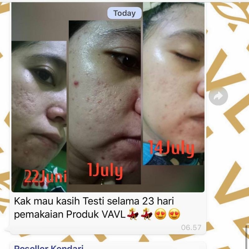 BLEMISH SERUM BY VIGHTNE