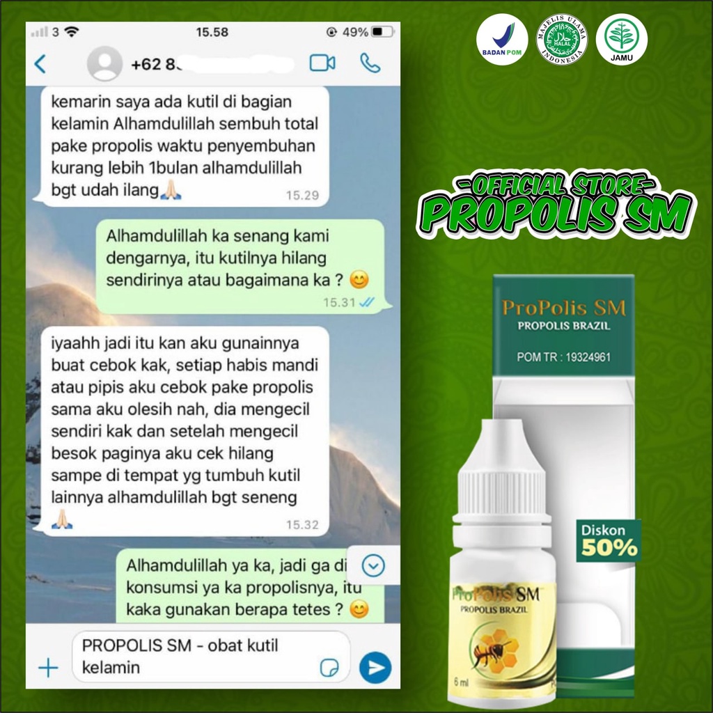 Penghilang Kutil Kelamin Benjol Di Kelamin Sariawan Vagina Bisul Di Kelamin - Pria Wanita Propolis SM-1