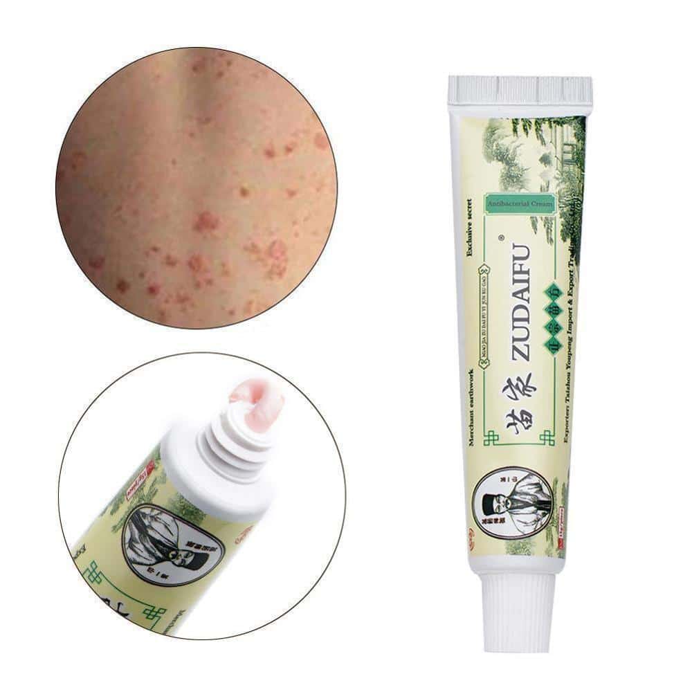 Original Cream Salep Zudaifu Obat Kulit Untuk Penghilang Gatal Jerawat Eksim Dermatitis Psoarisis Alergi Jamur Kurap Cream Salep Zudaifu Obat Gatal Sangat Ampuh Zudaifu Mandarin Cream Salep