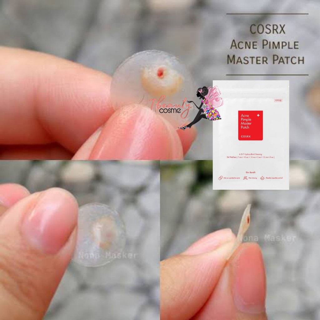 [5pcs]PLESTER JERAWAT COSRX ACNE PIMPLE MASTER PATCH&amp;CLEAR FIT MASTER PATCH