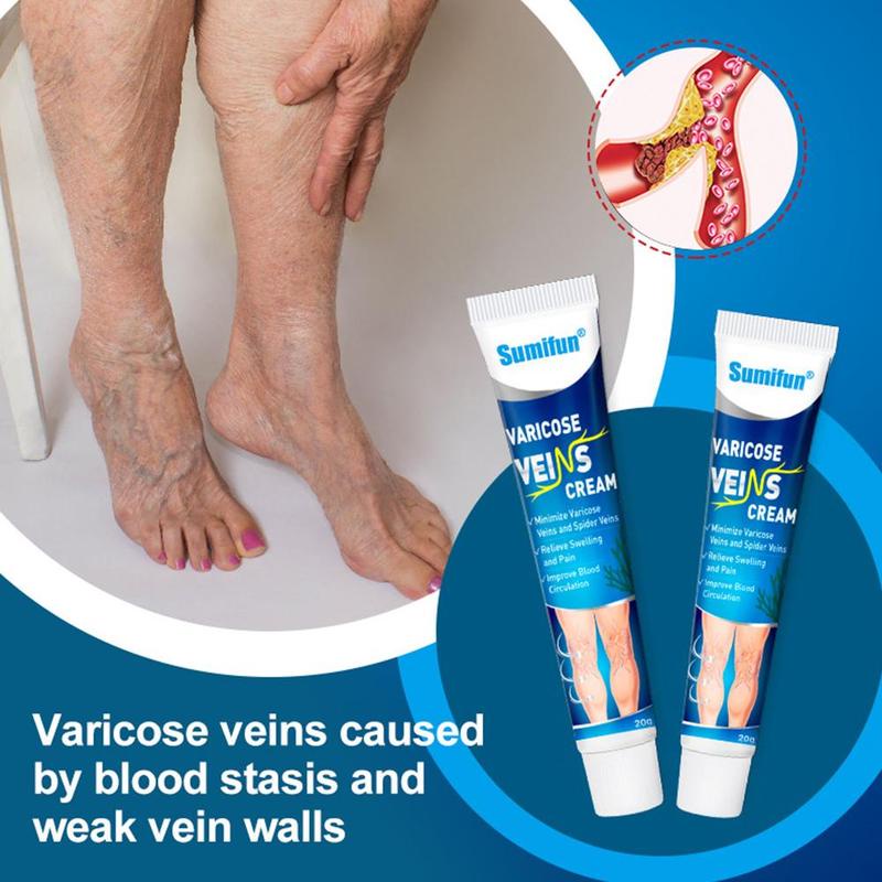 Salep Varises Cream Varicose Veins Obat Varises Kemaluan Bengkak Benjolan Buah Zakar Nyeri Testis Varicose Veins Cream 20Gr