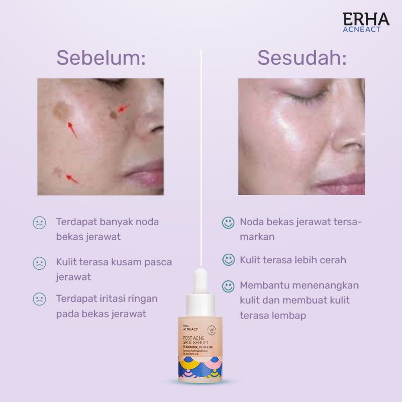 erha acneact post acne spot serum anti acne serum blemish soothing serum 30ml correcting for acne prone skin