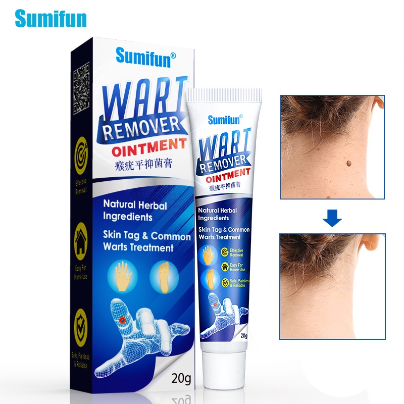 SUMIFUN Wart Remover Ointment  penghilang tahi lalat  obat penghilang tahi lalat  salep penghilang tahi lalat  obat kutil di leher  penghilang tai lalat