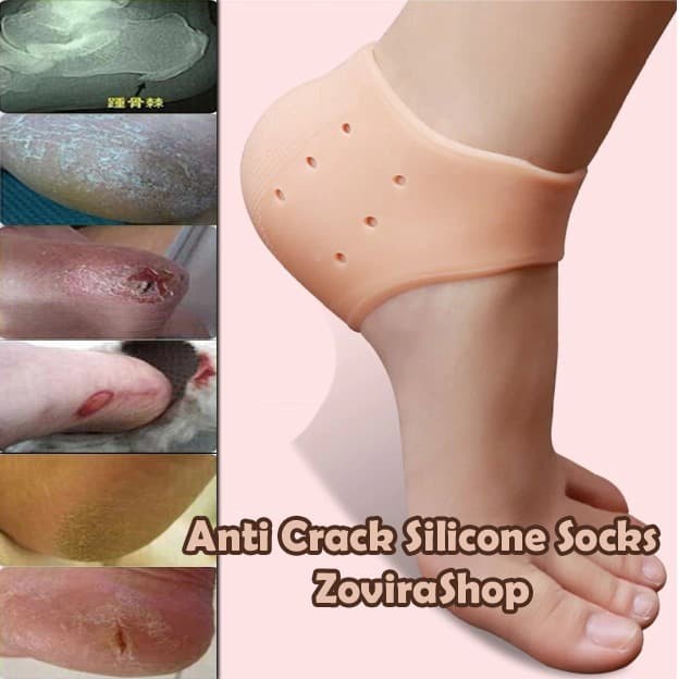 BAROKAH GAMIS ANTI CRACK SILICONE SOCKS SILICONE ANTI KULIT KAKI PECAH KERING KASAR