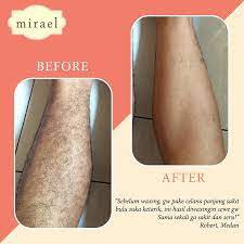 [ORIGINAL] Mirael Sugar Waxing Kit Hair Removal Pencabut Penghilang Pencukur Bulu Rambut Ketiak Kaki