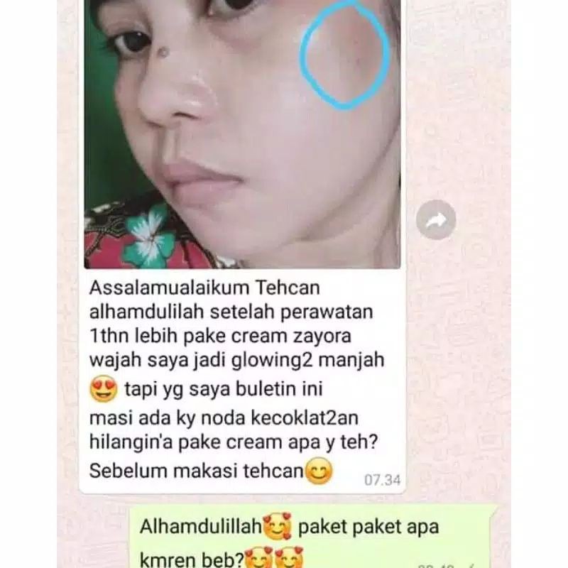 [ Salep Pemutih ] Salep Glowing Ampuh Putihkan Wajah 10 x Lebih Cepat Salep Pelicin Cream Pemutih Wajah/Salep Glowing Zayora Skincare/ Cream Glowing malam Ampuh