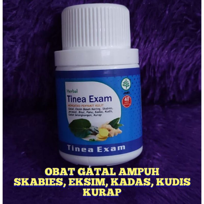 TINEA OBAT GATAL SELURUH TUBUH, EKSIM,JAMUR,SKABIES,30 kapsul