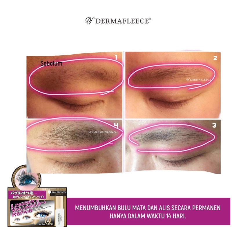 Maxgrowth dermafleece 14 days