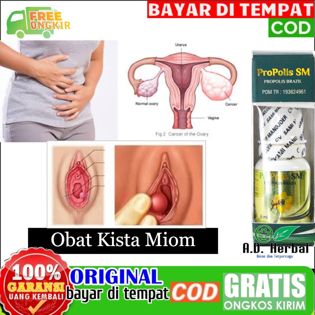 

Obat Kista Ovarium Miom Kista Wanita Kista Coklat Ginjal Di Jamin 100% ASLI BISA COD Propolis SM