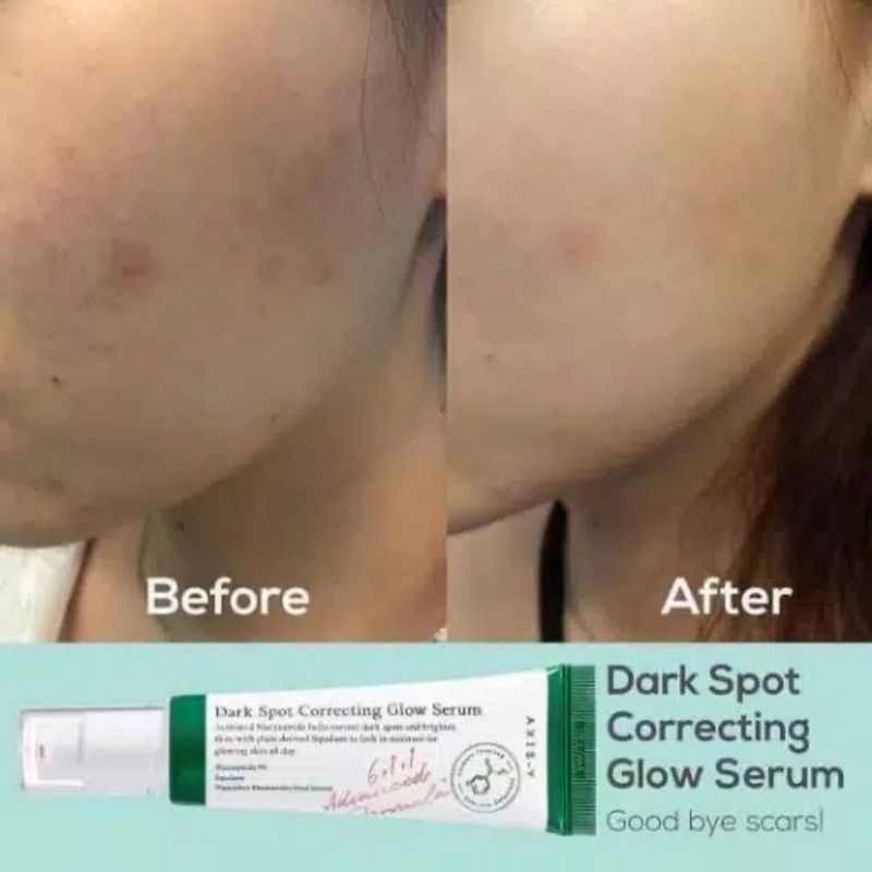 [BPOM] EXP 2024 AXIS-Y Dark Spot Correcting Glow Serum | Glowing Serum 50ml AXIS-Y Dark Spot Correcting Glow 50 ml | AXIS Dark Spot Correcting Glow  Serum | AXISY Dark Spot Correcting Glow Serum | Glowing Serum 50ml | Glowing Serum AXIS Y