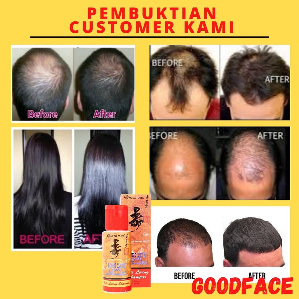 SHAMPOO METAL 100ML SAMPO METAL - PENUMBUH RAMBUT - PEMANJANG RAMBUT - PENUMBUH RAMBUT BOTAK