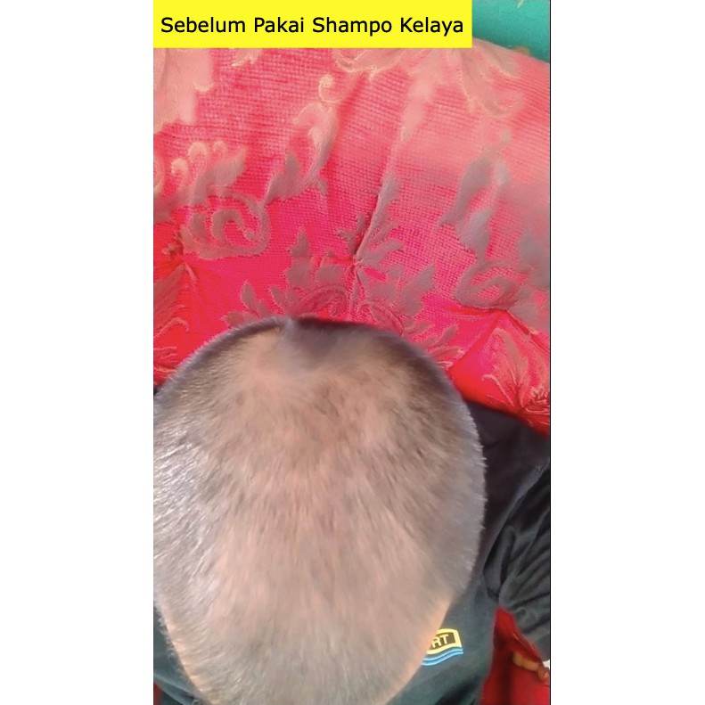 KELAYA HAIR TREATMENT SHAMPOO SOLUSI RAMBUT RONTOK & KEBOTAKAN 250ML-6