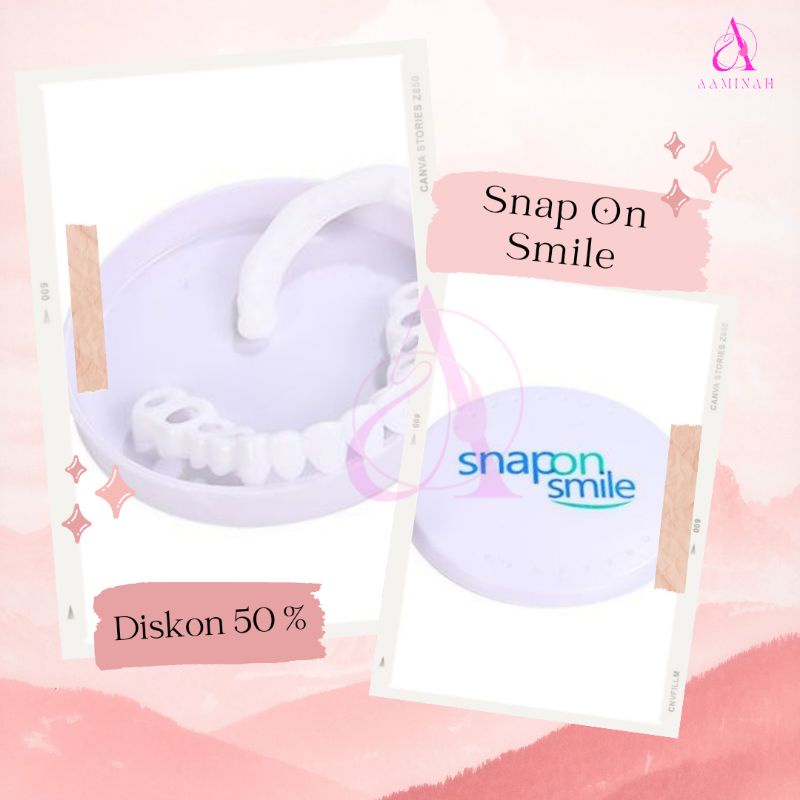 Ideal Smile Gigi Palsu Atas Bawah Gigi Palsu Lepas Pasang Veneer