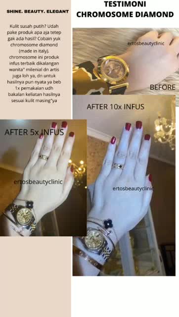 READY Chromosome Diamond/Cromosom/Suntik Putih Kromosom/infus whitening