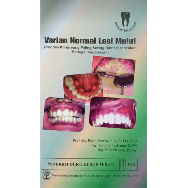 Varian Normal Lesi Mulut
