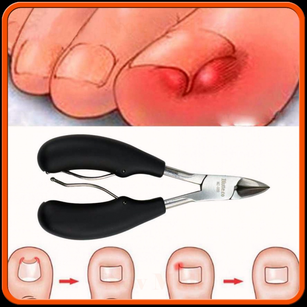 Gunting Kuku Jempol Kaki Anti Cantengan Nail Clipper - BY600