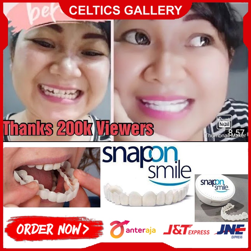 Snap On Smile Veneer Gigi Palsu Instan Atas Bawah Original 100 % Asli
