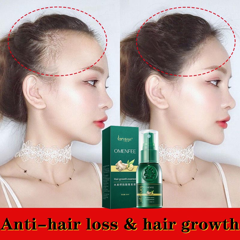 pertumbuhan rambut Hair Growth Essence Esensi Semprotan jahe 30ml Hair Treatment Shampoo Botak Rontok germinal rambut Perawatan Hair Care Efektif Menumbuhkan Rambut