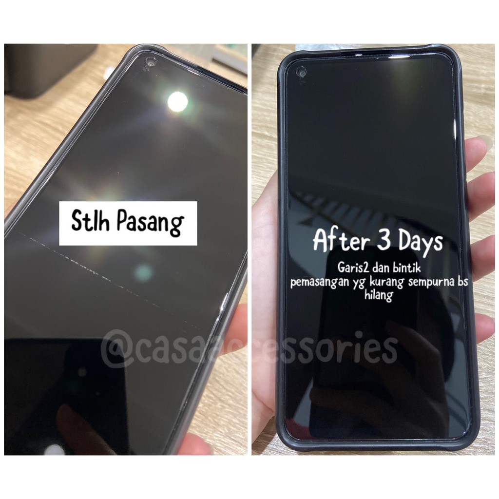 CASA Screen Protector Jelly / Hydrogel Depan Belakang - All Phone Types [Anti Gores Semua Type HP]