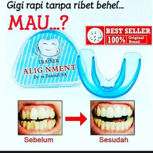 Alat merapikan gigi..