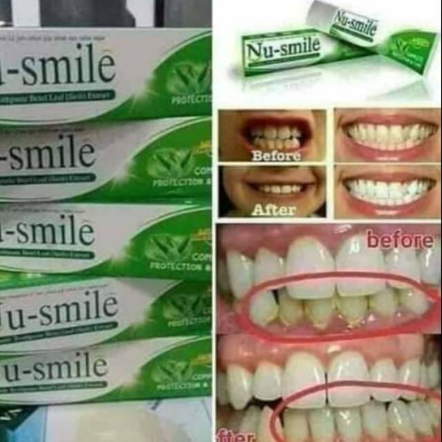 Nu Smile (Pasta gigi)