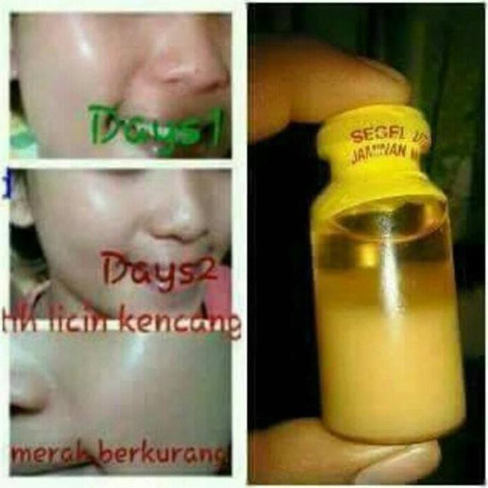RISMA MINYAK BULUS 10ML ASLI ORIGINAL