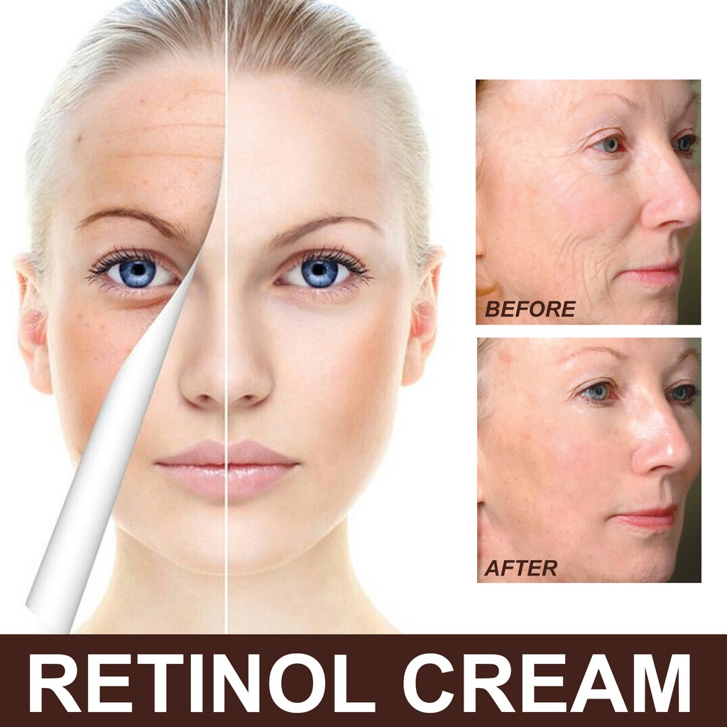 EELHOE Retinol Cream Moisturizing Cream 30gr Krim Wajah Pelembab Pemutih dan Anti Penuaan Kerut Perawatan Kulit