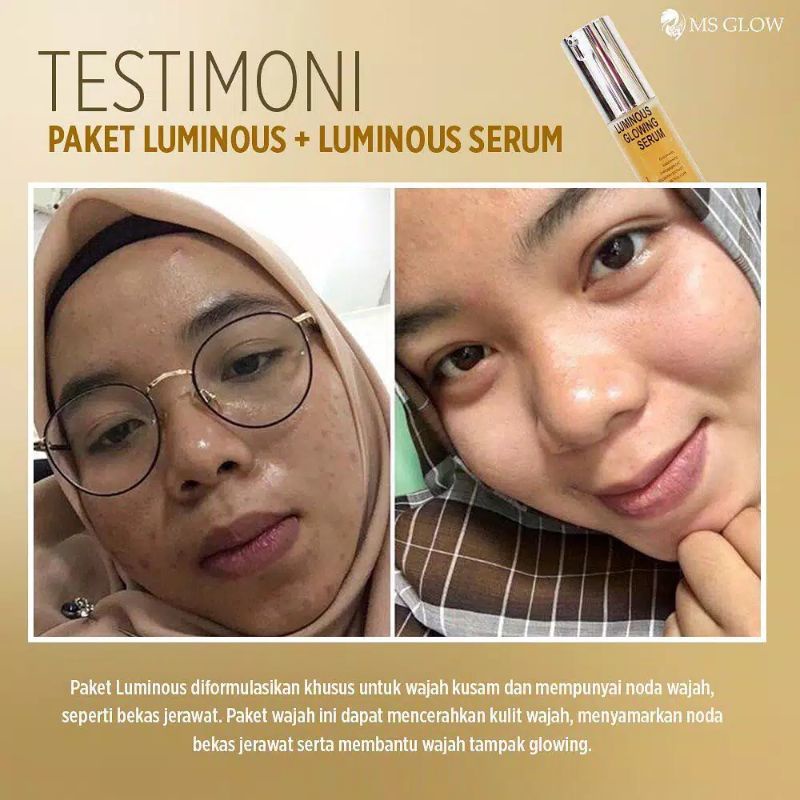 SERUM MS GLOW ORIGINAL (SUDAH BER BARCODE) / SERUM WHITE CELL DNA / SERUM WHITENING GOLD / SERUM ACNE / SERUM LUMINOUS SERUM LIFTING PEELING