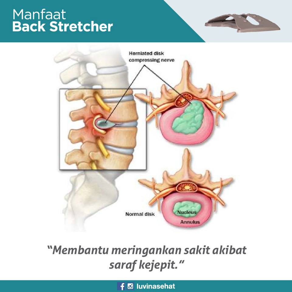 Luvina Back Stretcher - Alat Terapi Nyeri Pinggang Saraf Kejepit