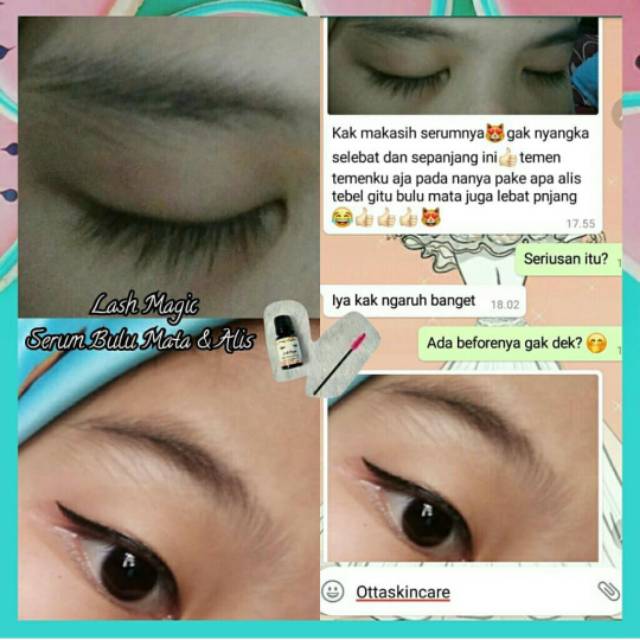 Lash Magic Serum Menebalkan Melentikan Bulu Mata Alis Shopee Indonesia