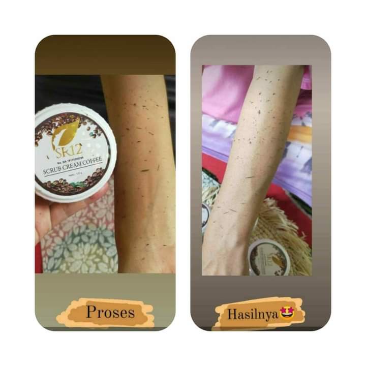 SR12 Body Scrub Kopi Lulur Pemutih Selangkangan Pemutih Badan Penghilang Daki BPOM