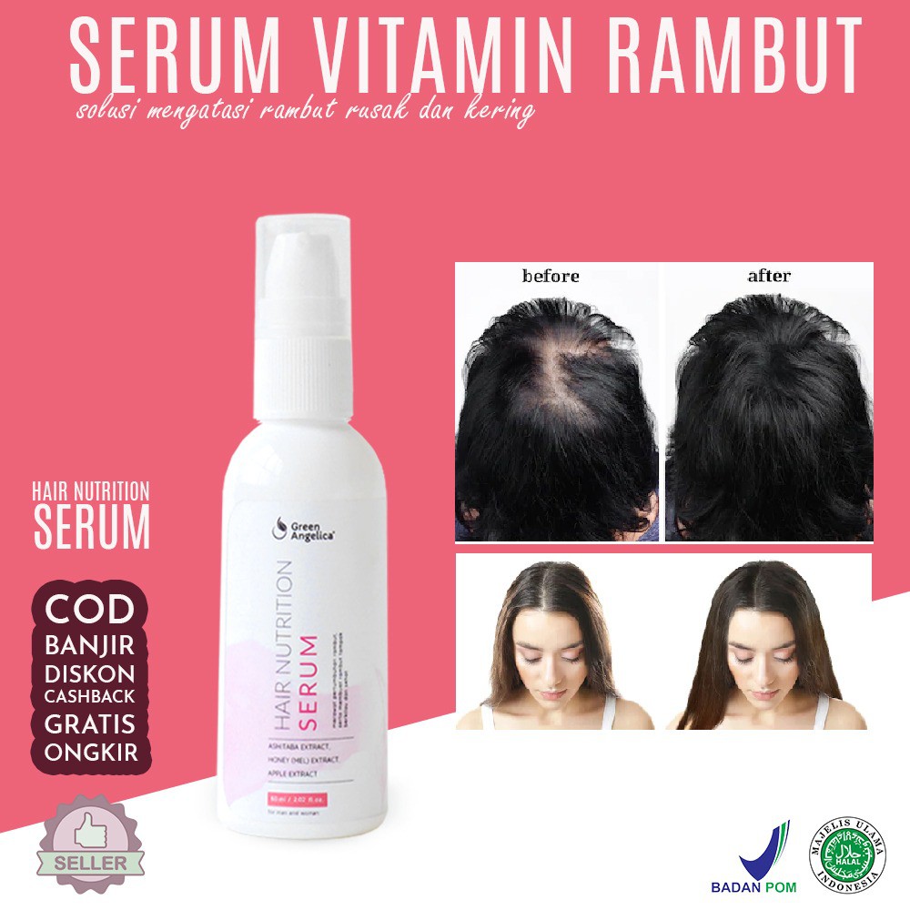 Hair Serum Vitamin Penebal Rambut Panjang Dan Sehat Green Angelica Hair Growth Serum Vitamin Penumbu Shopee Indonesia