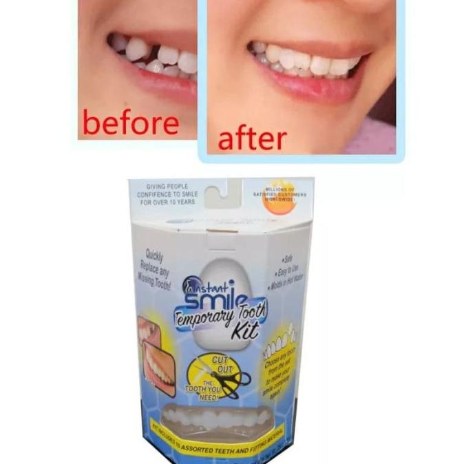 Gigi Palsu Instan Tempel Temporary Tooth Kit