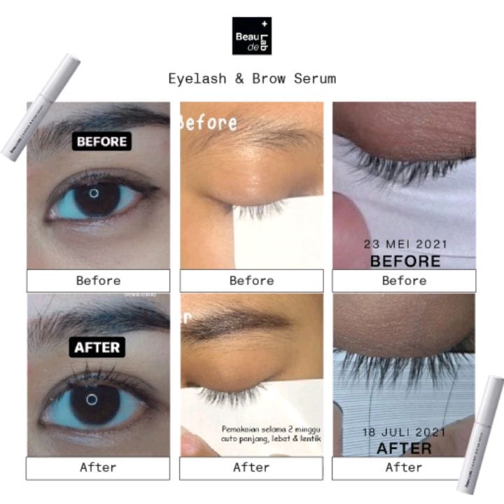 BEAUDELAB SERUM BULU MATA BPOM | PENUMBUH ALIS &amp; BULU MATA CEPAT INSTANT | EYELASH EXTENSION &amp; BROW GROWTH SERUM