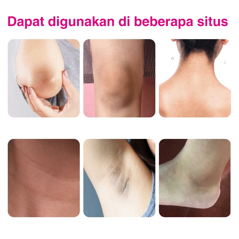 【Barang spot】pemutih mencerahkan, melembapkan, tubuh ketiak selangkanganCream Private Part Krim Pemutih 50ml Merah muda untuk bagian pribadi untuk menghilangkan melanin