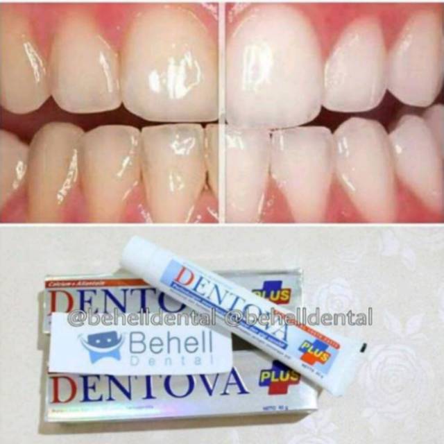 Pasta Gigi Kesehatan Mulut Pemutih . Obati Sariawan, Gusi . Dentova. Teeth bleaching whitening