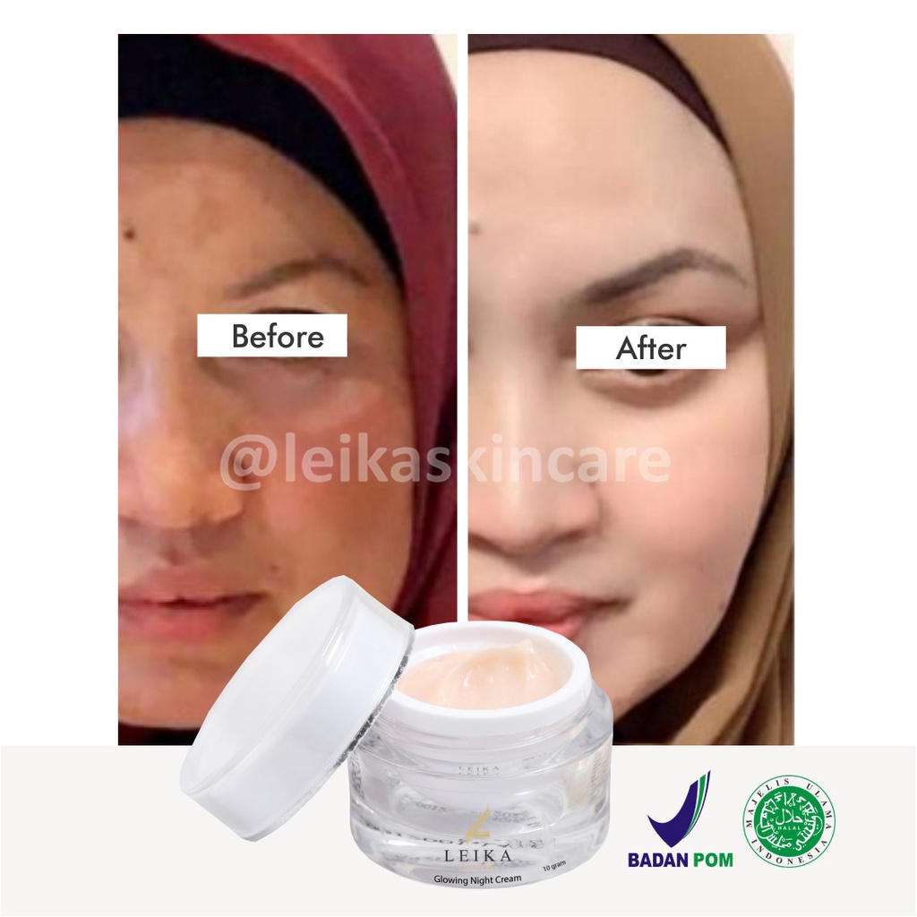 Krim Anti Penuaan Wajah Ampuh! Krim Anti Aging Wajah Korea Terbaik Resmi BPOM Krim Anti Penuaan Dini Asli Halal MUI Glowing Night Cream Anti Aging Leika Skincare 10gr