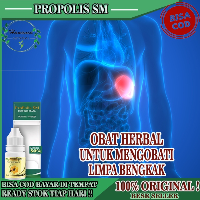 Obat Limpa Bengkak,  Obat Pembengkakan Limpa, Pembengkakan Limpa Herbal, Obat Herbal Limpa Bengkak, 