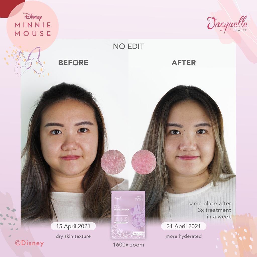 Jacquelle Disney Minnie Mouse Edition Primer Lipo Mask - Sheet Mask Lipomask Jacquele Jac quelle quele