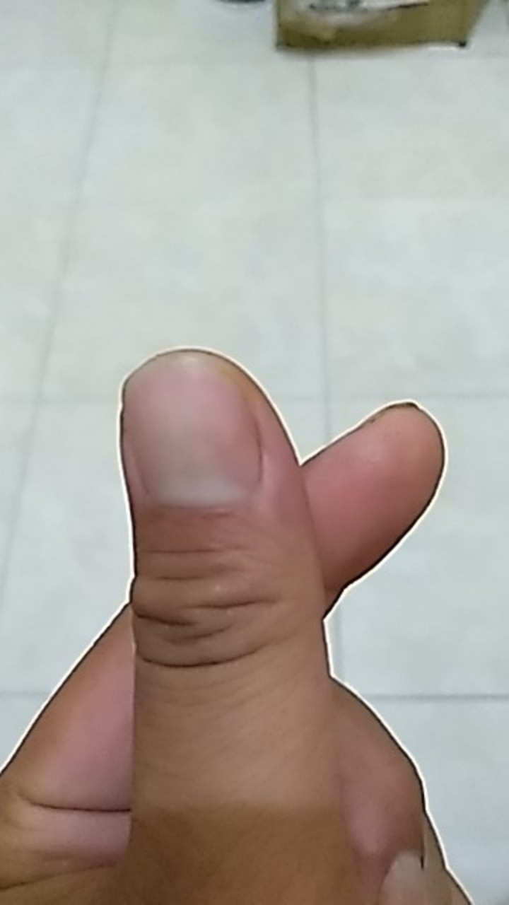 Bayclin Pemutih Pakaian 500ml Disinfektan Anti Bakteri