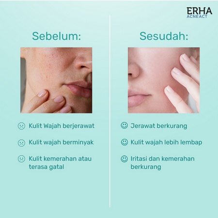 ⭐BAGUS⭐ ERHA Acneact AHA BHA &amp; Niacinamide Clarifying Toner 60mL - Toner Wajah Berjerawat