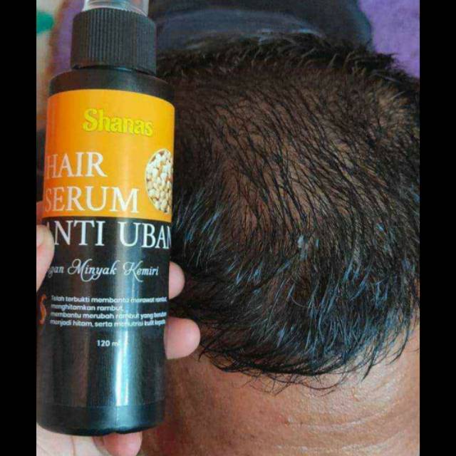 SHANAS ANTI UBAN AMPUH 100%